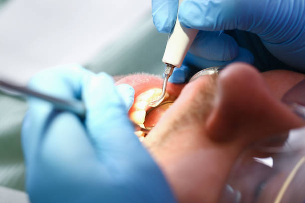 Best Broken Tooth Emergency  in Temple Terrace, FL